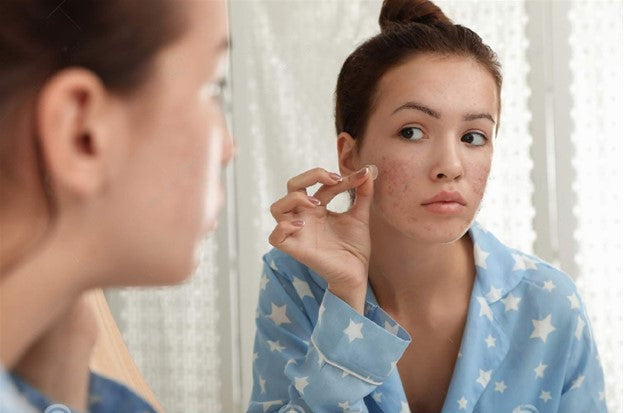 Why Pimple Patches Work for Tweens!