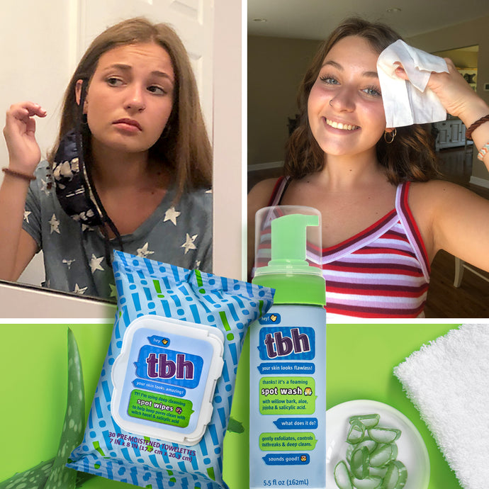 Maskne and Your Teen’s Skincare Routine: How to Prevent Acne Around Mouth